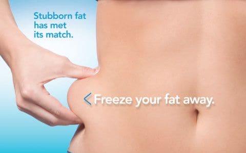 Hips treatment Balsall From Lipo Sculpt