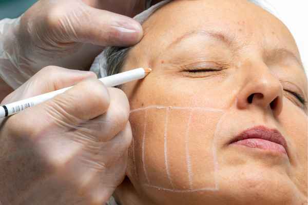 CryoPen: 5 Skin Concerns It May Be Used to Treat 4 What should you ask before having CryoPen treatment Balsall?