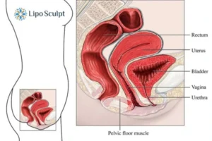 Treatment For A Leaky Bladder 2 How EM Chair treatment Balsall can help Leaky bladder issues. Read more now!