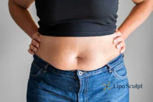 Bidding Farewell to Muffin Tops with Aqualyx Fat Injections 2 Do you wish you could reduce your muffin top Balsall With Aqualy fat dissolving injections you can!