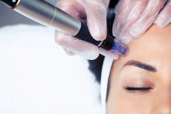 Explaining Total Skin Tightening Treatment and What to Expect 2 What Skin Concerns Can Total Skin Tightening Treatment Help With Balsall?