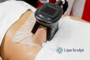 Does Fat Freezing At Home Work? 3 Fat freezing at home from Lipo Sculpt Balsall